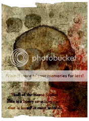 SkulloftheHomoSapienThisisaboneystructur